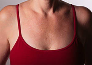 Decolette Pads!!! To remove unsightly chest wrinkles..Brilliant Results the next day!!!